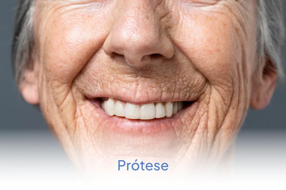protese_dental_ipatinga